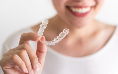Ventajas del Invisalign: por qué elegir este tratamiento