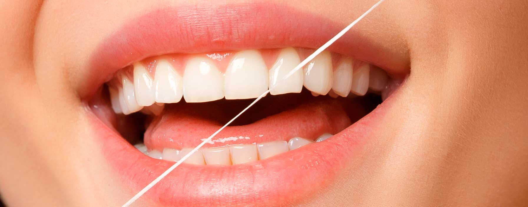 Usa hilo dental para evitar sangrado de encías