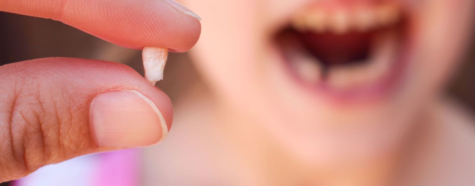 Dientes de leche